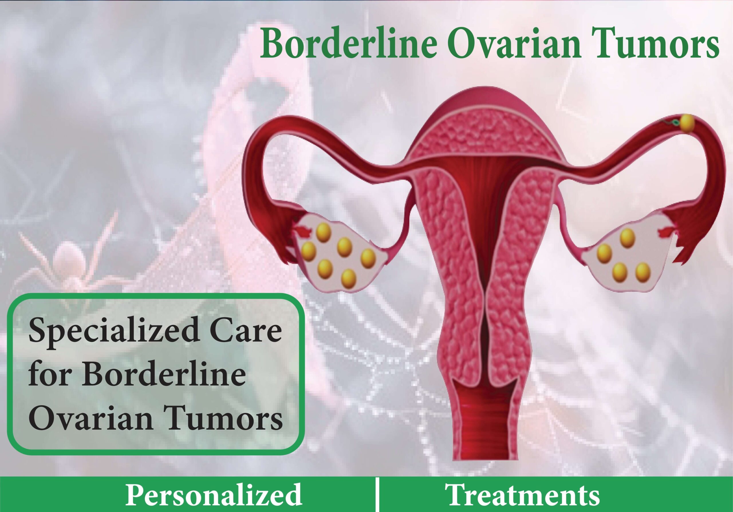 Borderline Ovarian Tumors